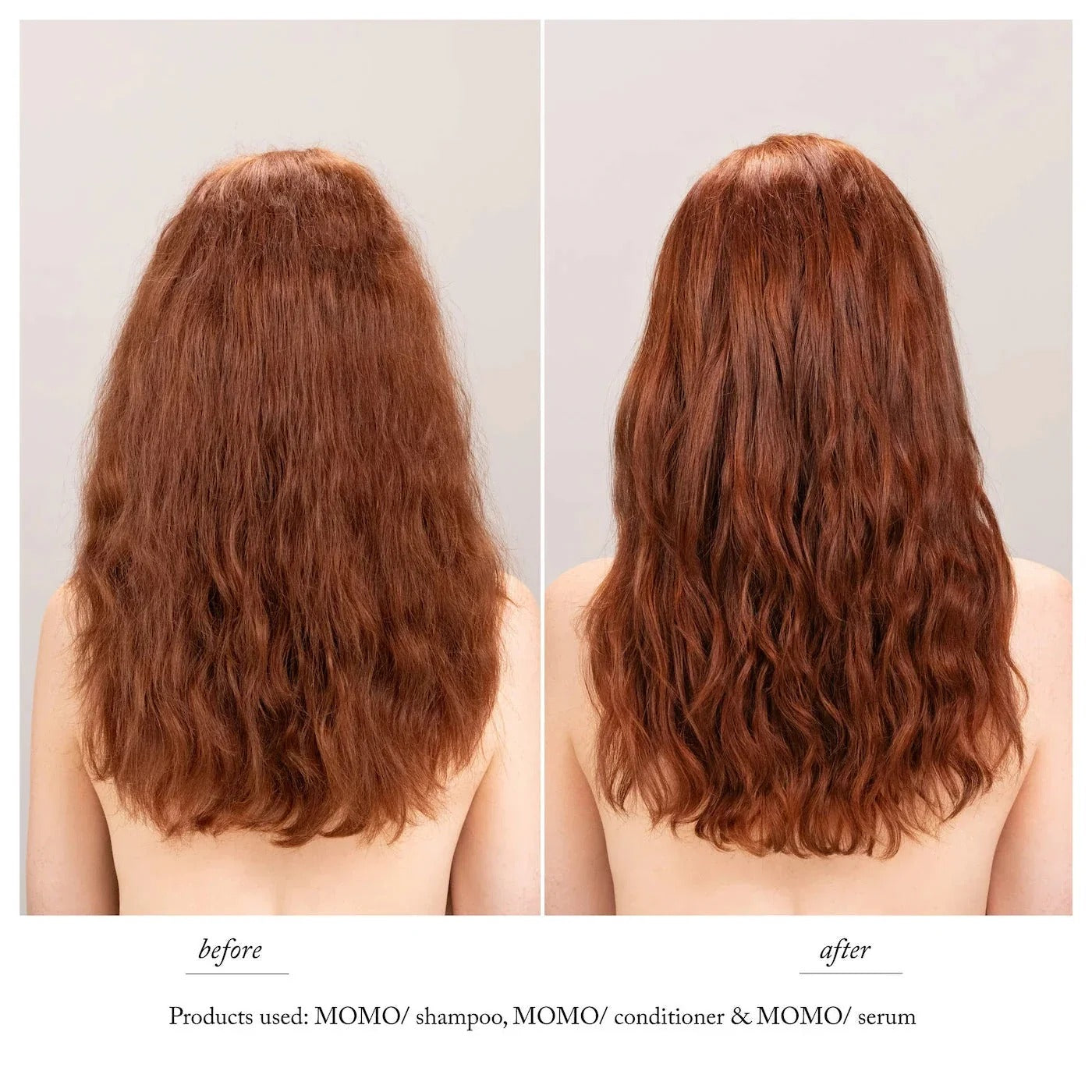Essential Momo Shampoo – Moisturizing & Nourishing Shampoo for Dry & Damaged Hair