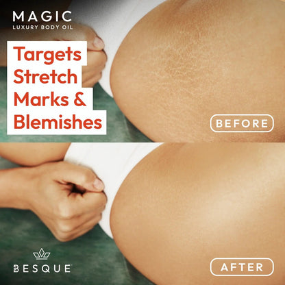 Besque® Magic Body Oil | Nourishing & Hydrating Body Oil
