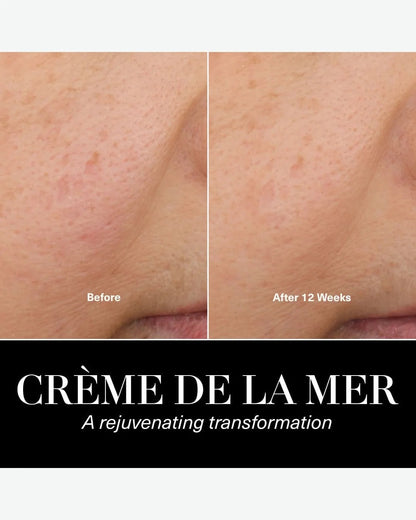Crème de la Mer Moisturizing Cream – Luxury Anti-Aging Facial Moisturizer